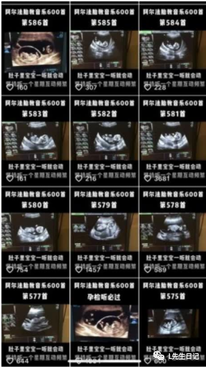 胎教音乐:一天几百跟玩一样,适合宝妈在家搞的2个小项目